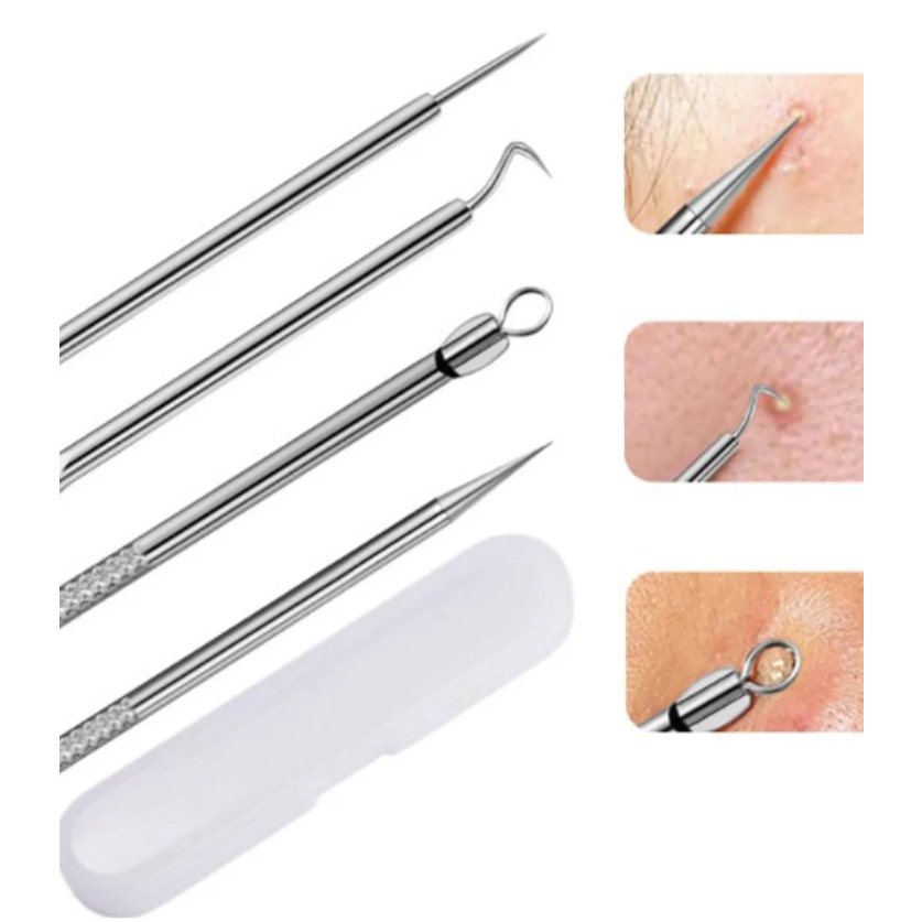 Tratamento de Acne e Cravos com 4 Ferramentas - Cuide da Sua Pele com Profissionalismo em Casa