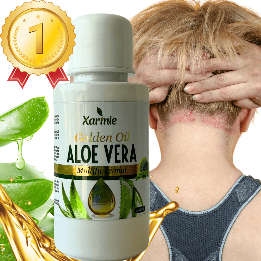 Calmante e Alivio Para Psóriase Óleo de Babosa Aloe Vera 100% Natural Hidratante 100ml