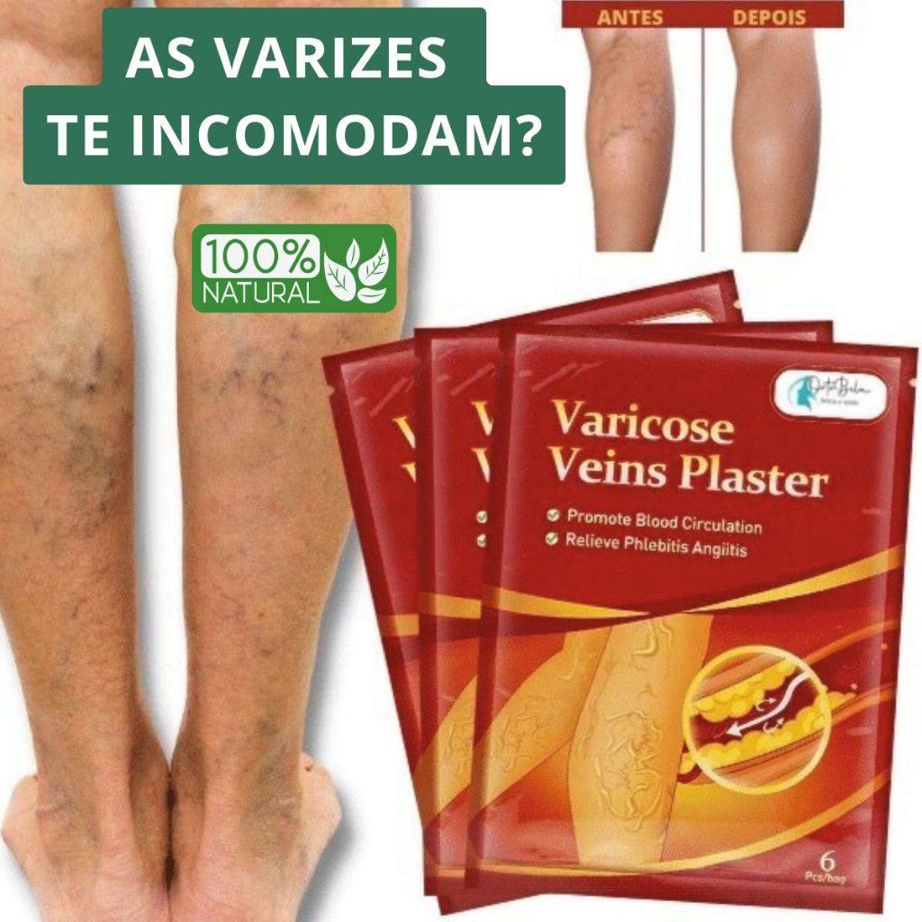 Kit Adesivos Para Varizes Vasos e Veias