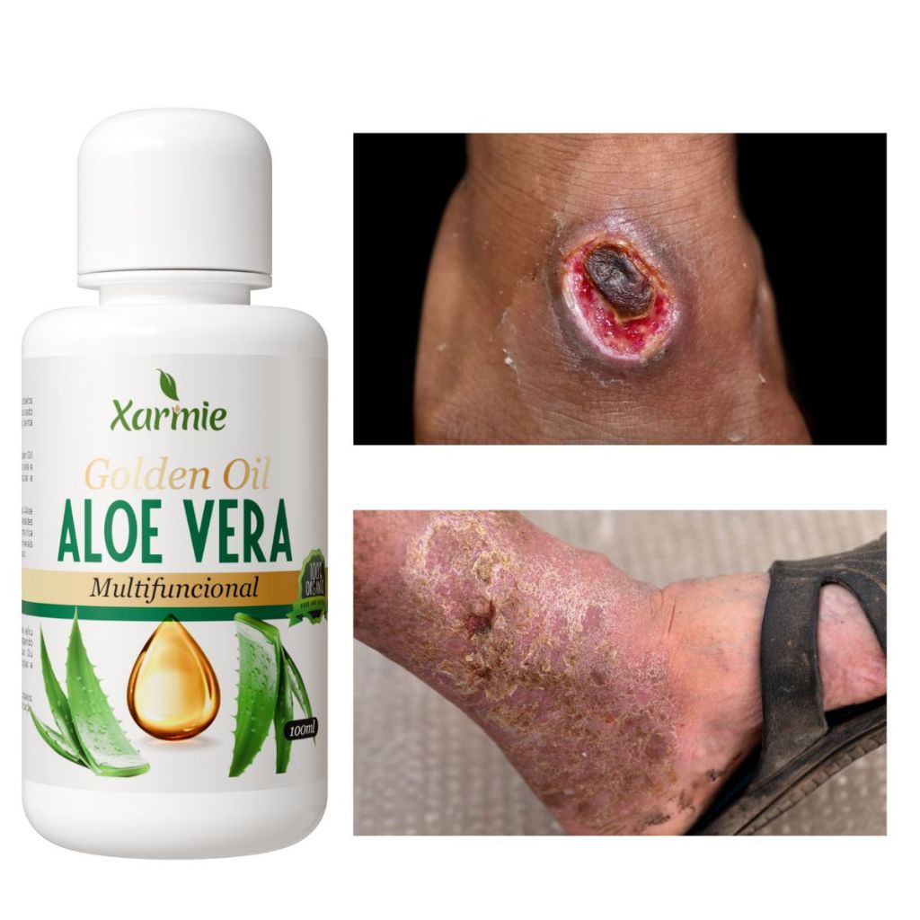 Óleo de Aloe Vera 100% Natural para Idosos – Cicatrização Pele Madura