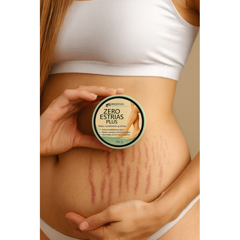 Creme Zero Estrias Plus Removedor Anti Estrias Trata E Previne 150g - RedFour