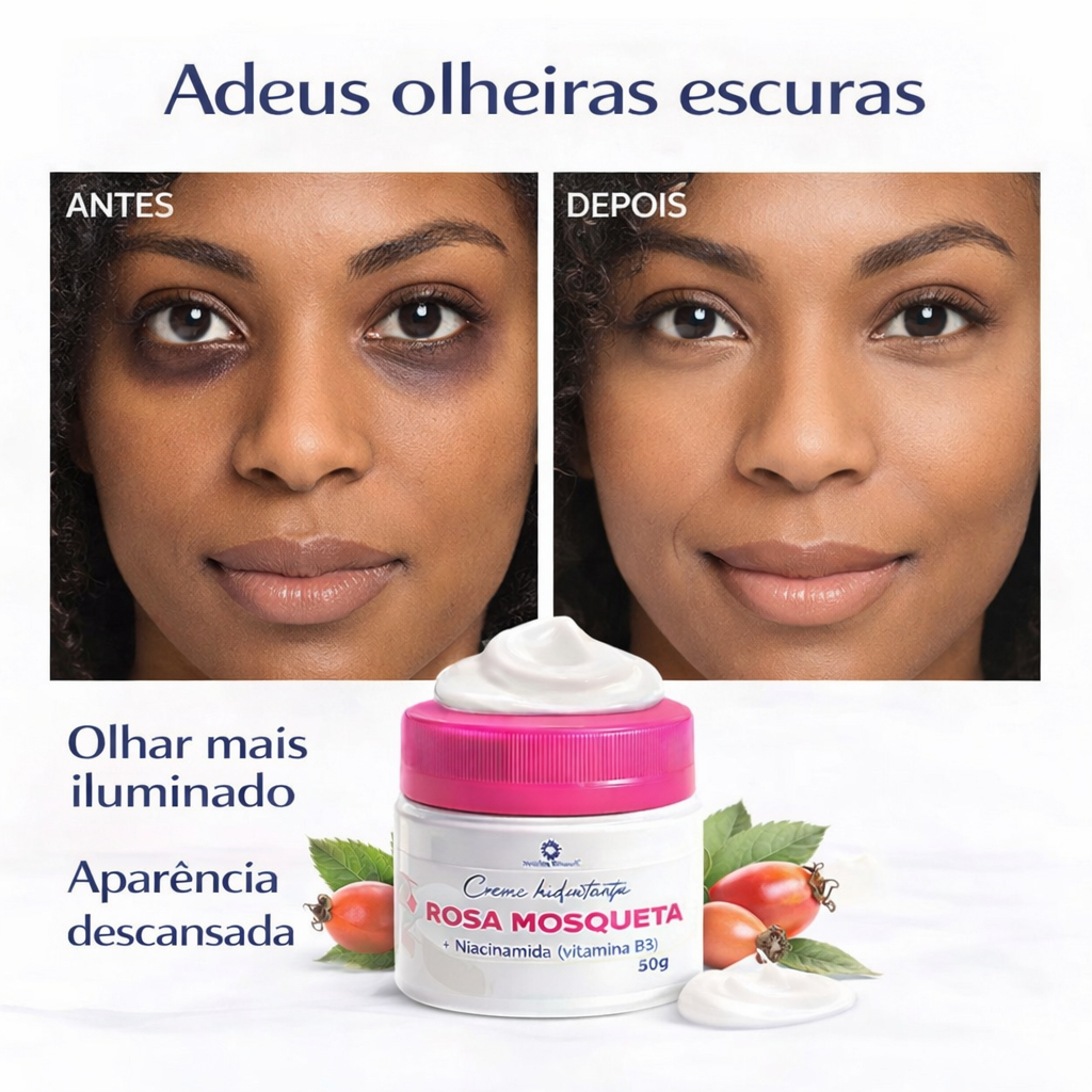 Creme rosa mosqueta clareador para olheiras areas escurecidas e manchas