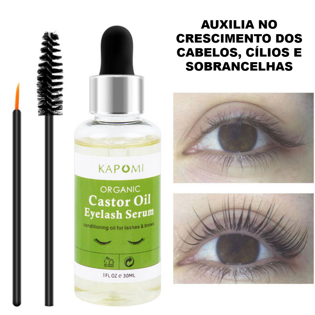 Oléo de Rícino 100% Natural Auxilia no Crescimento dos Cabelos, Cílios, Barba e Sobrancelhas