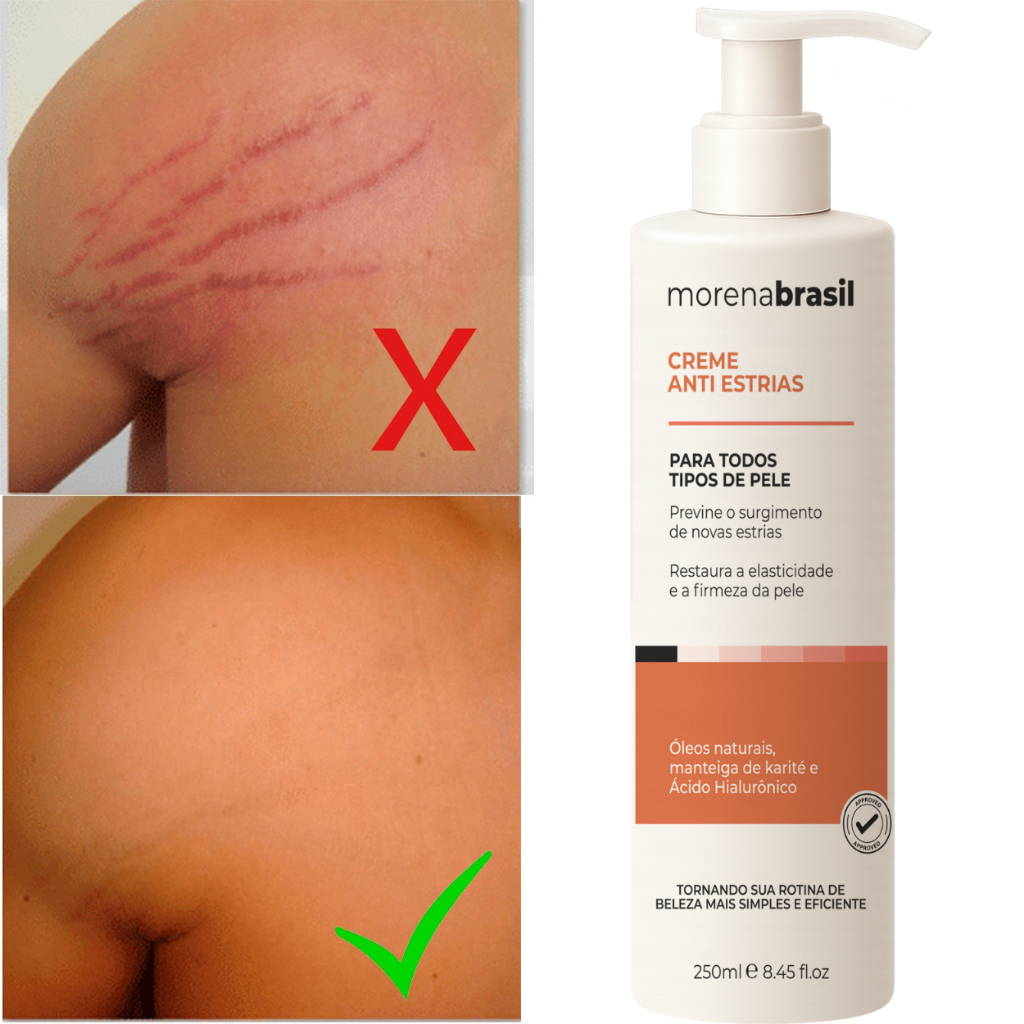 Creme Anti-Estrias Morena Brasil -  Ação Poderosa com Colágeno e Elastina