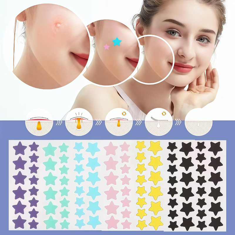 Patches Blogueiras Remoção Acne Forma Estrela Adesivos Cuidados Faciais Espinhas Manchas
