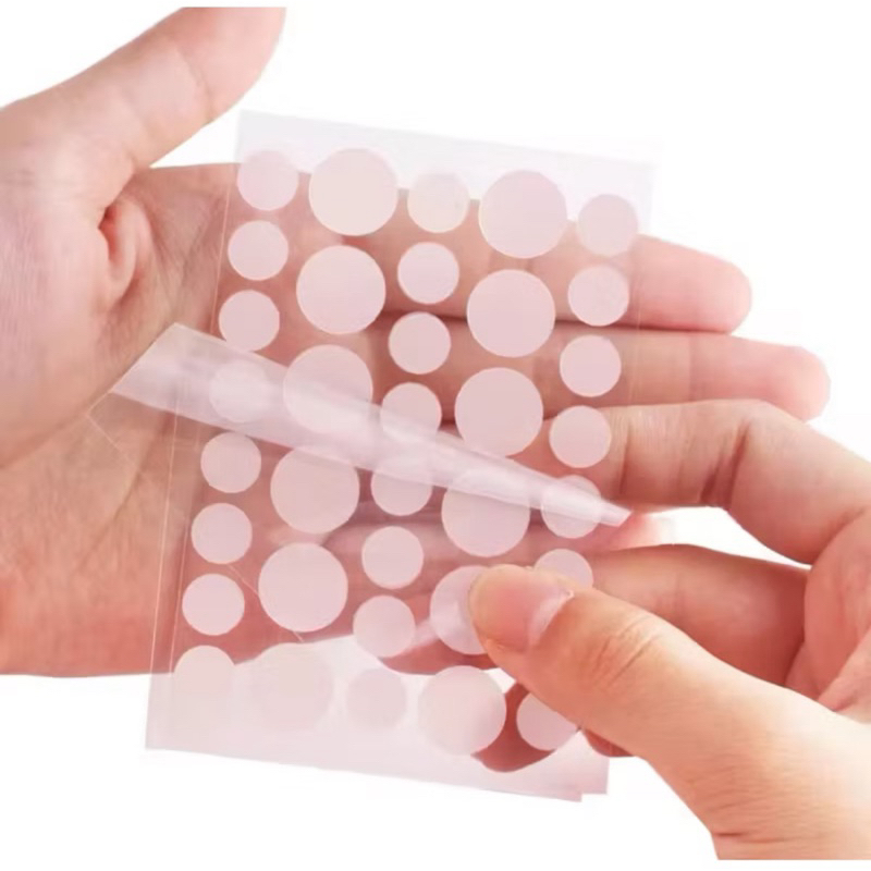Kit com 36 Adesivos Hidrocoloide Anti Acne Patch Secativo Espinha Invisível