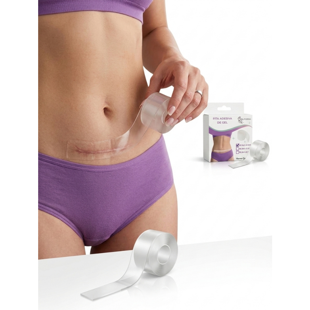 Fita Adesiva Abdominal Cicatriz Hipertrófica Queloide 35x3cm SILIFORMA
