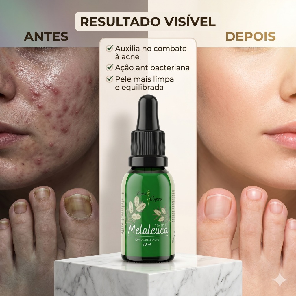 Óleo Essencial Melaleuca Tea Tree 30ml 100% Puro Antisséptico Natural Acne Oleosidade Fungos Unhas