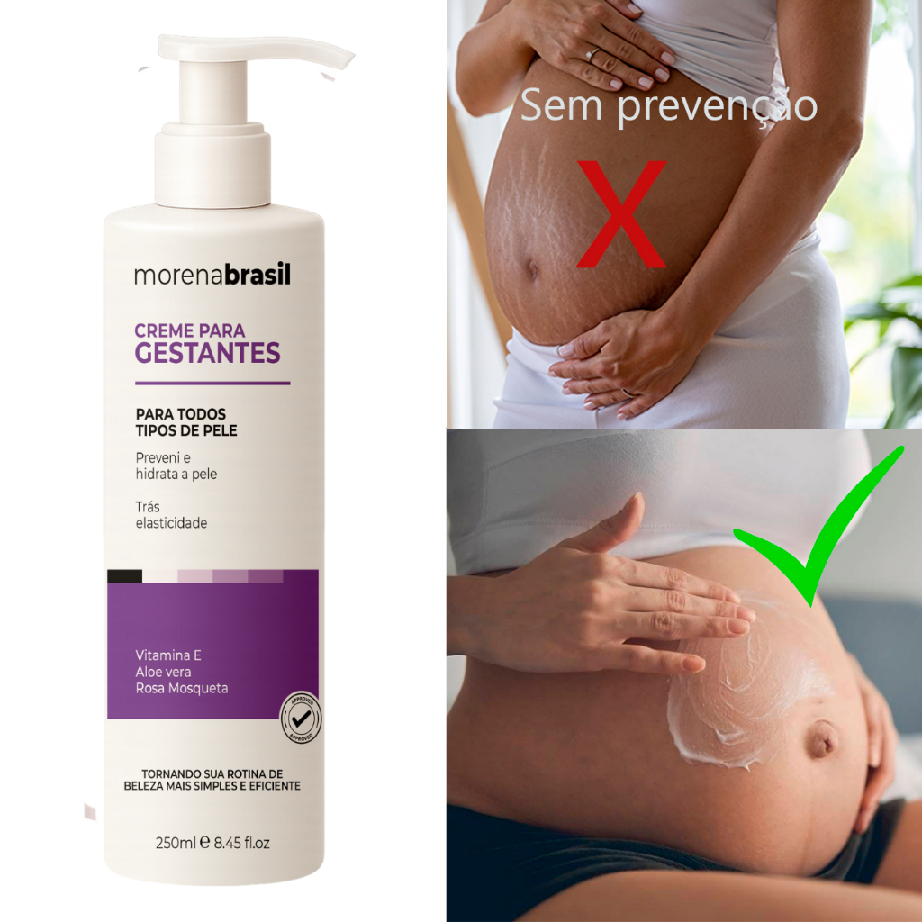 Creme Prevenção de Estrias  – Segurança e Hidratação para Mamães