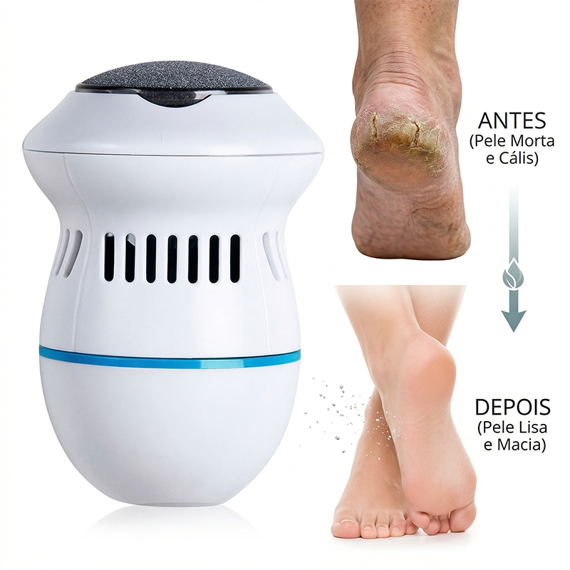 Removedor Elétrico De Calos De Lixa De Pé , Ferramenta De Pedicure Recarregável Para Calcanhares Rachados De Pele Morta 