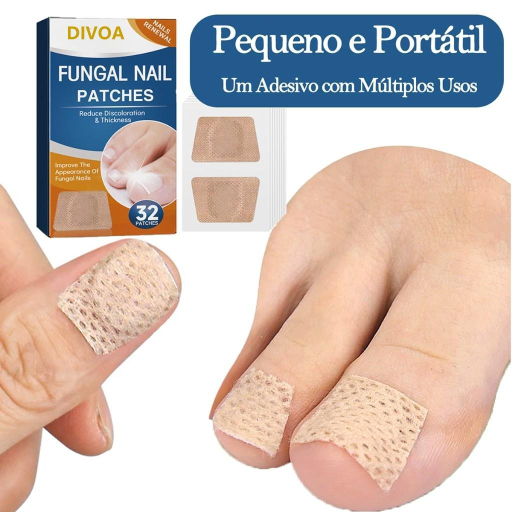 Adesivo Anti-Fungo Unhas Onicomicose Kit 32/64 unid Eficaz para Fungos nas Unhas Amarelas e Grossas Pés e Mãos