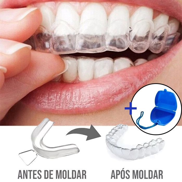 2 unidades (1 par) + Estojo Moldeira Molde Silicone Bruxismo Caseiro Protetor