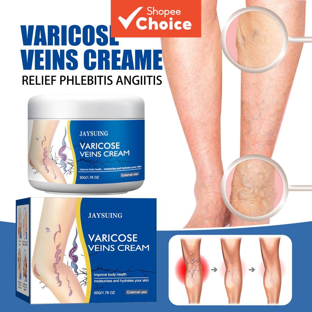  Creme para Varizes nas Pernas 50g, Creme Suavizante e Hidratante, Ajuda na Circulação e Pele com Aspecto Saudável,
