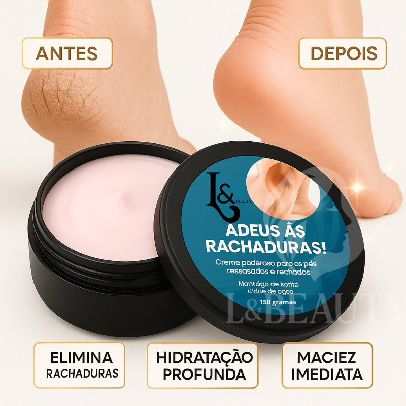 Creme Para Rachaduras Fissura Dos Pés Tratamento 150g - L&Beauty
