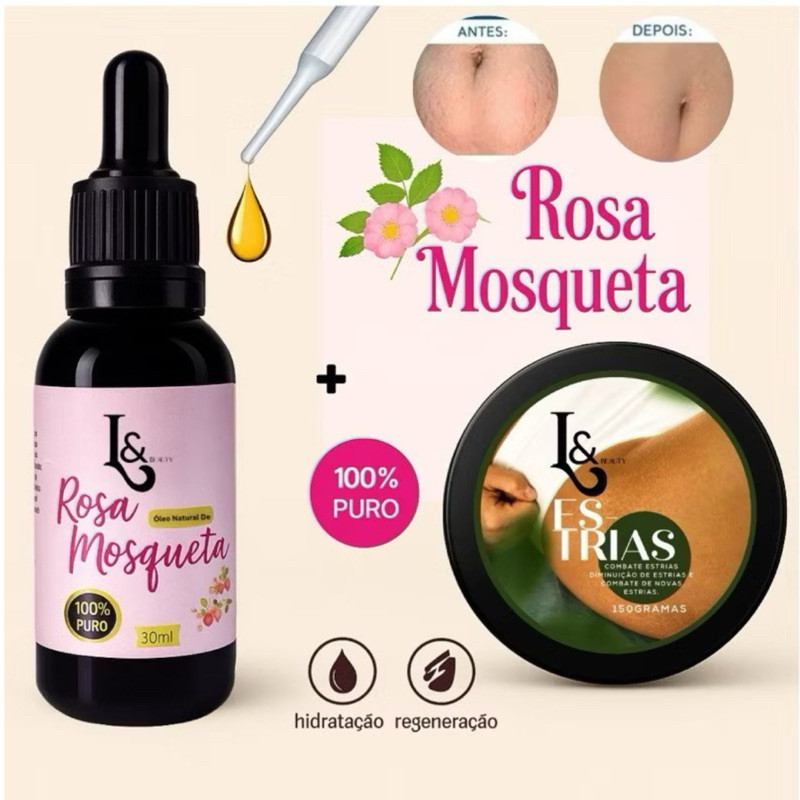 Kit Creme Redutor Estrias  + Óleo Rosa Mosqueta 100%  - L&Beauty