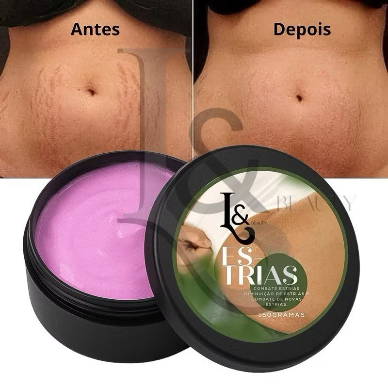 Creme reduz Estrias  Anti Estrias Trata E Previne 150g - L&Beauty