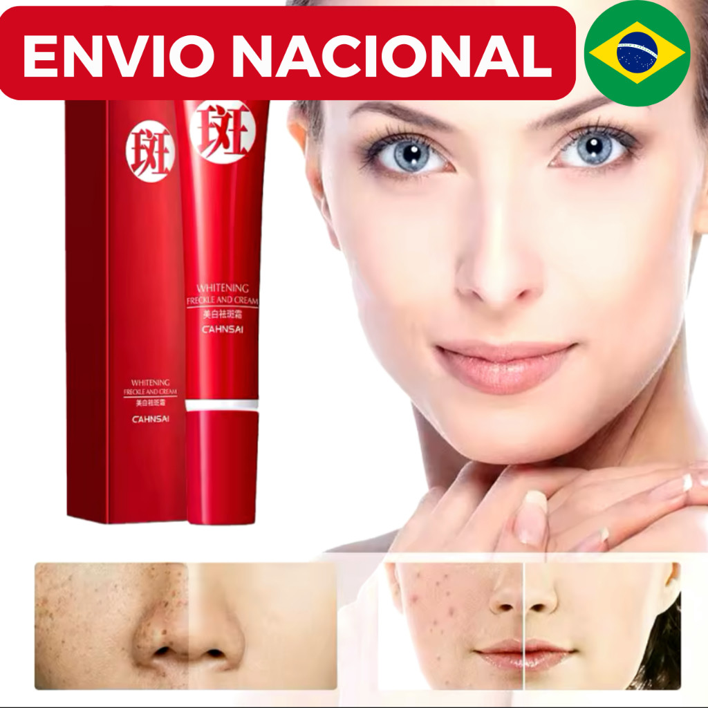 Creme forte original para remover manchas escuras/clareamento pigmentado/cuidados com a pele