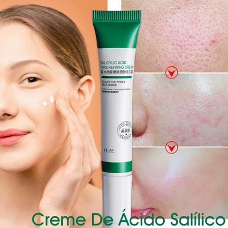 Ácido Salicílico Acne Creme Remover Cravo Controle De Óleo Anti-Tratamento Reparação Espinha Cicatriz Clareamento Facial