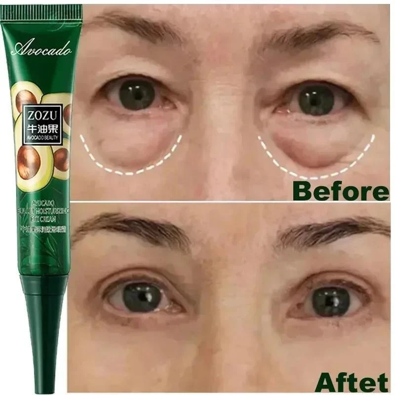 KIT 1/2 Creme Instantâneo Antirrugas Para Os Olhos Anti-Olheiras Bolsas E Produtos Inchados Cuidados Com A Pele