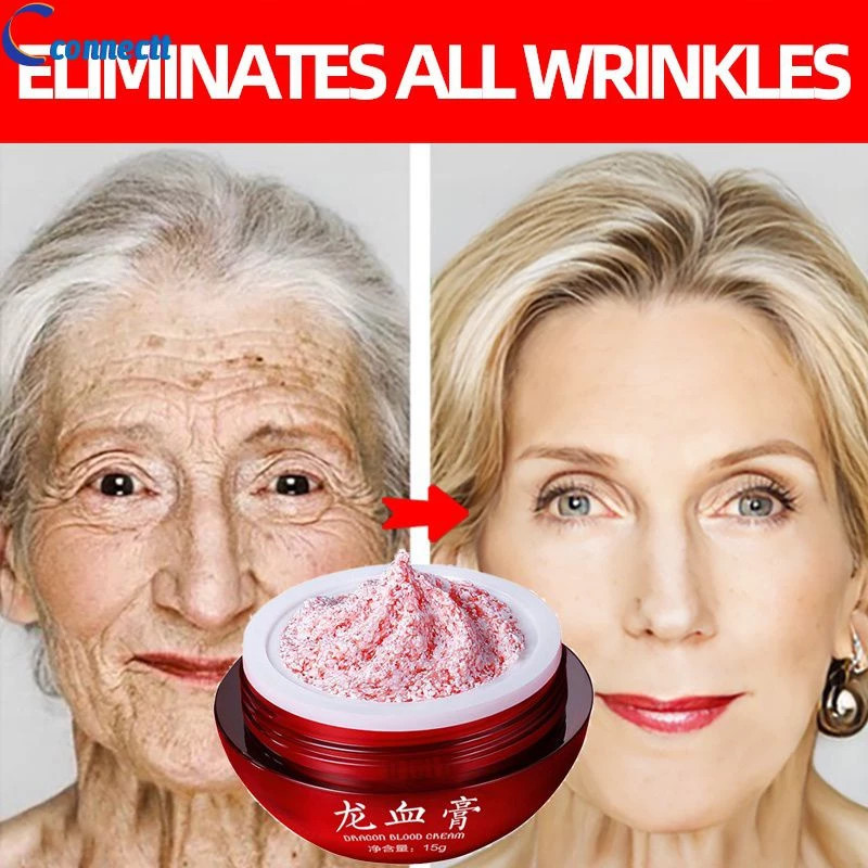 Creme De Sangue De Dragão Quente ! Omelin Retinol Placenta Royal Hidratante Iluminação Essência Natural Antienvelhecimen