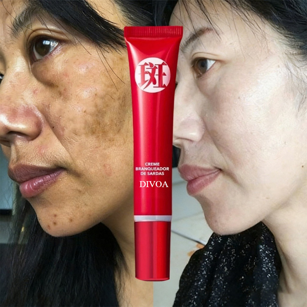 Produtos de clareamento, usados para remover manchas escuras/coloração desbotada calma/cuidados com a pele