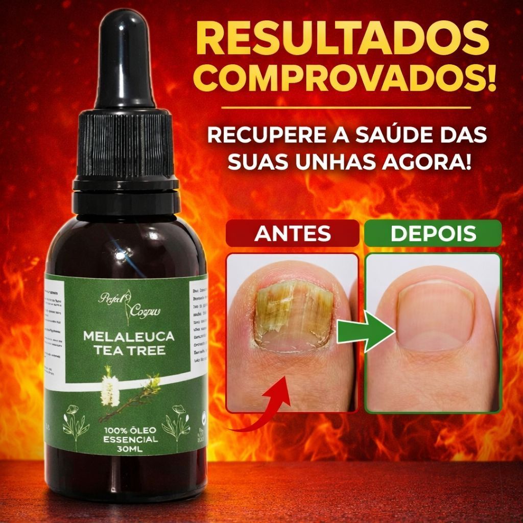 Óleo Melaleuca Essencial Embalagem Contra Gotas 100% Puro 30ML