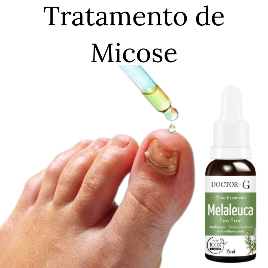 Oleo Essencial Melaleuca 100% Puro Australiano Tea Tree 15ML